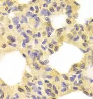 MAP2K1 antibody - image 1