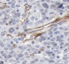 MAP2K4 antibody - image 1