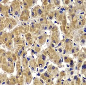 MMP14 antibody - image 1