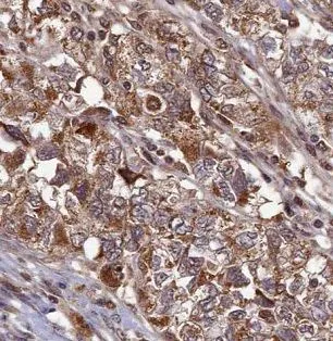 NCOR1 antibody - image 1