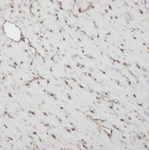 NDC80 antibody - image 1
