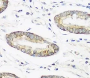 NEDD4 antibody - image 1