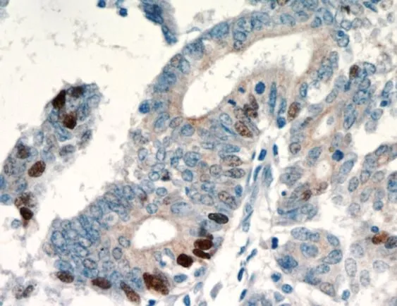 TP53 antibody - image 1