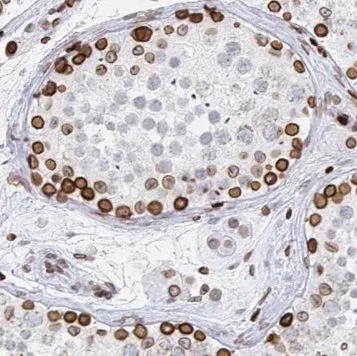 PABPC3 antibody - image 1
