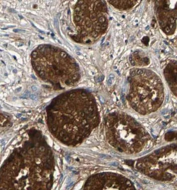 PAK4 antibody - image 1