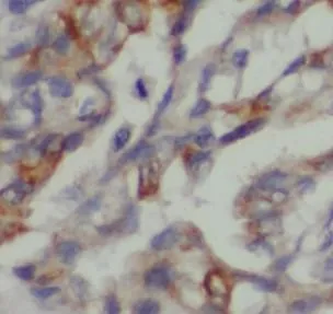 PANK2 antibody - image 1