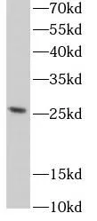 PAQR4 antibody - image 1
