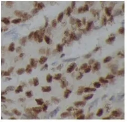 PARP1 antibody - image 1