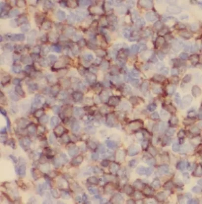 PD-1 antibody - image 1