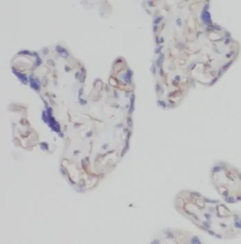 PDIA5 antibody - image 1
