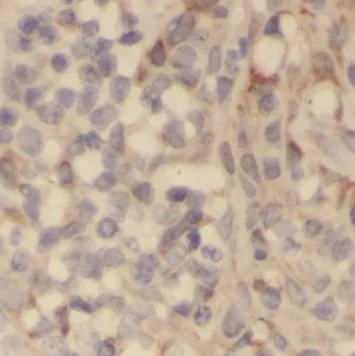 PLAC8 antibody - image 1