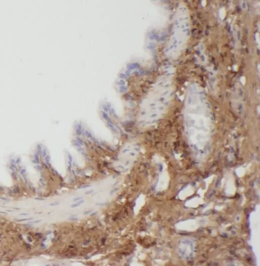PLEKHO2 antibody - image 1