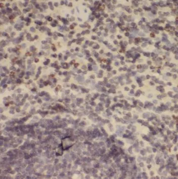 POLM antibody - image 1