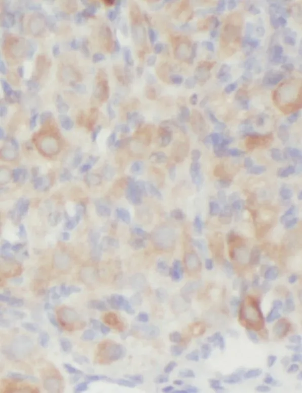 RAB3C antibody - image 1