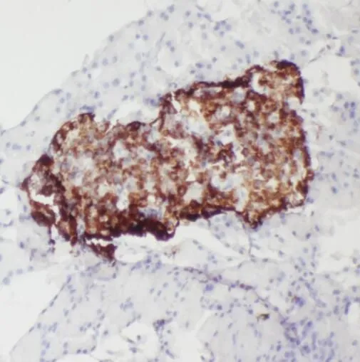 RASEF antibody - image 1