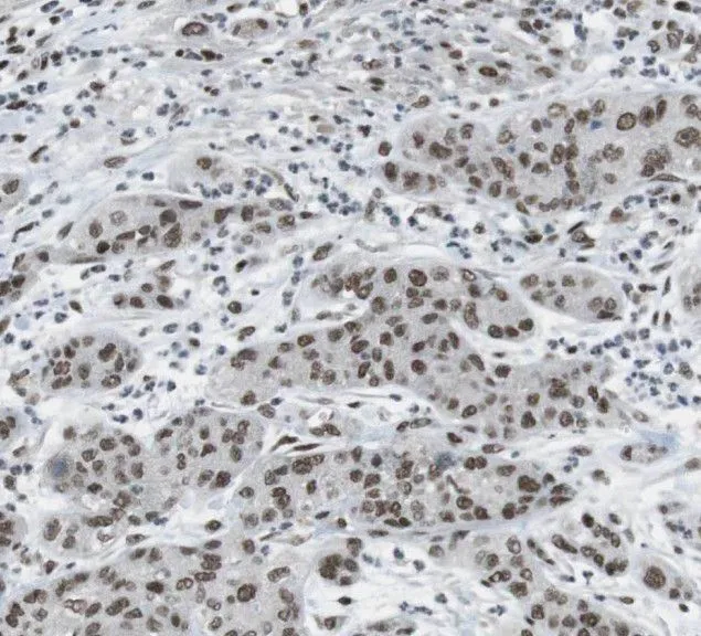 RBP1 antibody - image 1