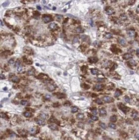 RBP4 antibody - image 1