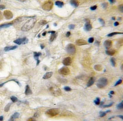 RECQL5 antibody - image 1