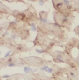 ATP6AP2 antibody - image 1