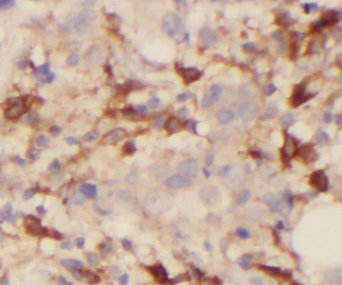 ROR1 antibody - image 1