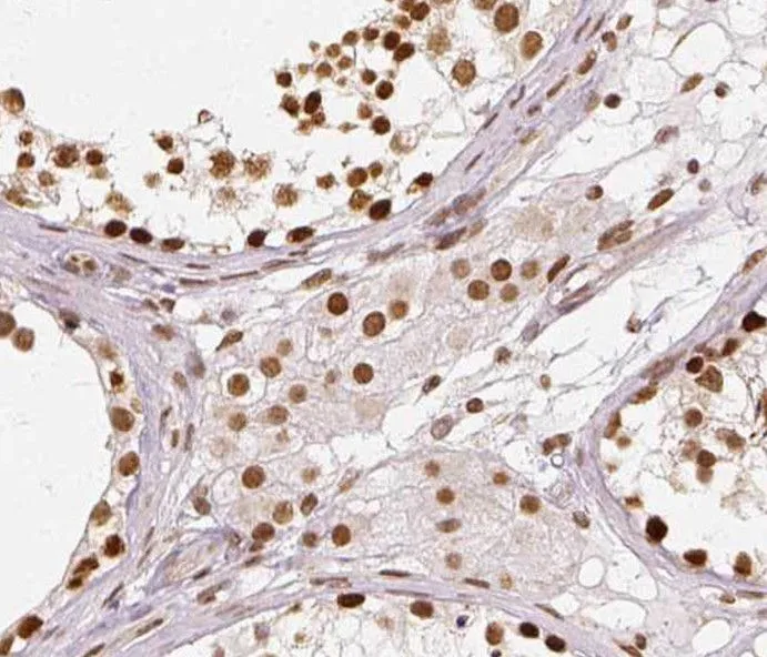 RUNDC3A antibody - image 1
