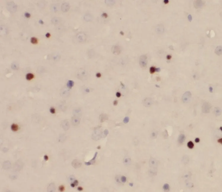RUNX1T1 antibody - image 1