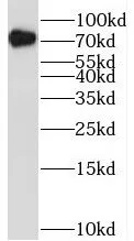 RUNX1T1 antibody - image 2