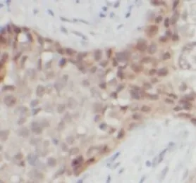 S100B antibody - image 1