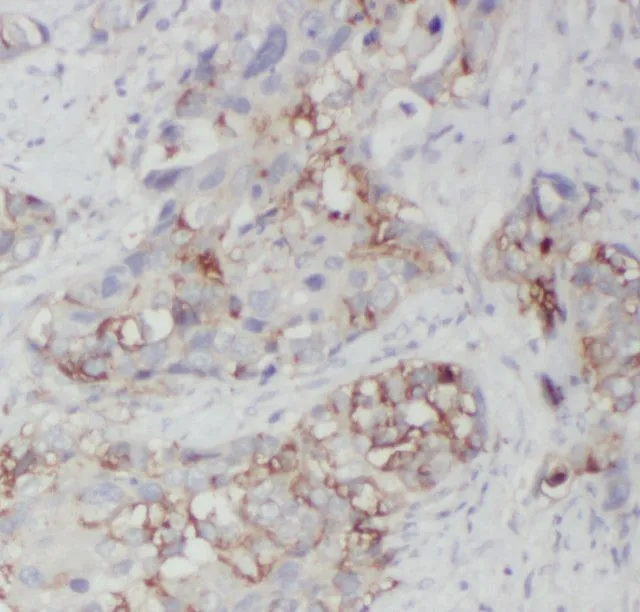 NEMF antibody - image 1
