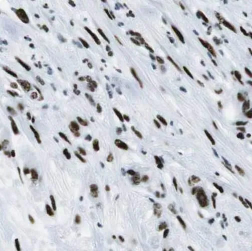 SGK3 antibody - image 1