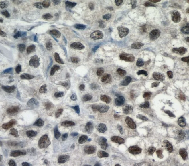SMARCA4 antibody - image 1