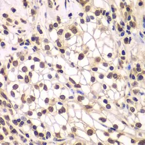 SMARCC1 antibody - image 1