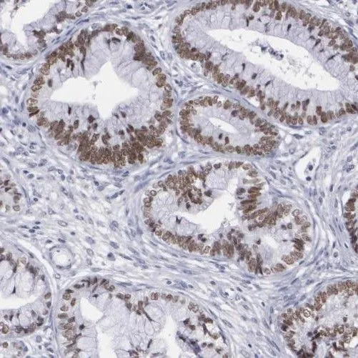 SMARCD2 antibody - image 1