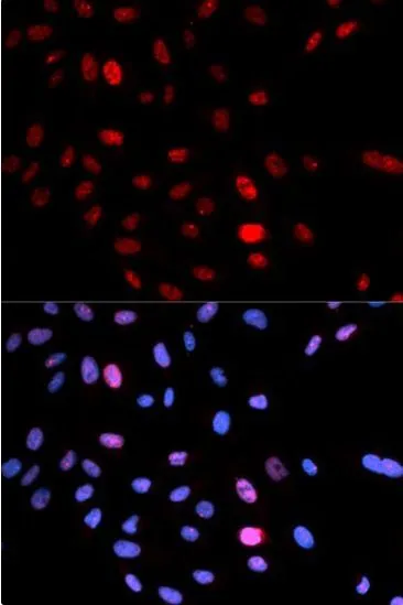 SMC1A antibody - image 1