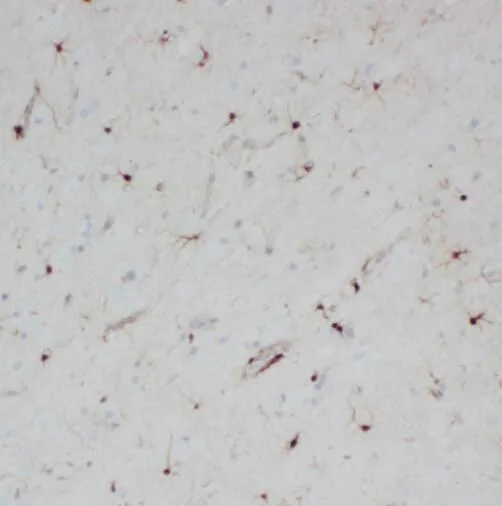 SPAG16 antibody - image 1