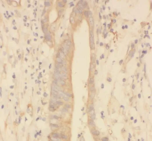 SPRR3 antibody - image 1