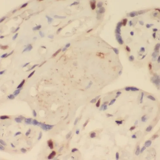 SRPX2 antibody - image 1