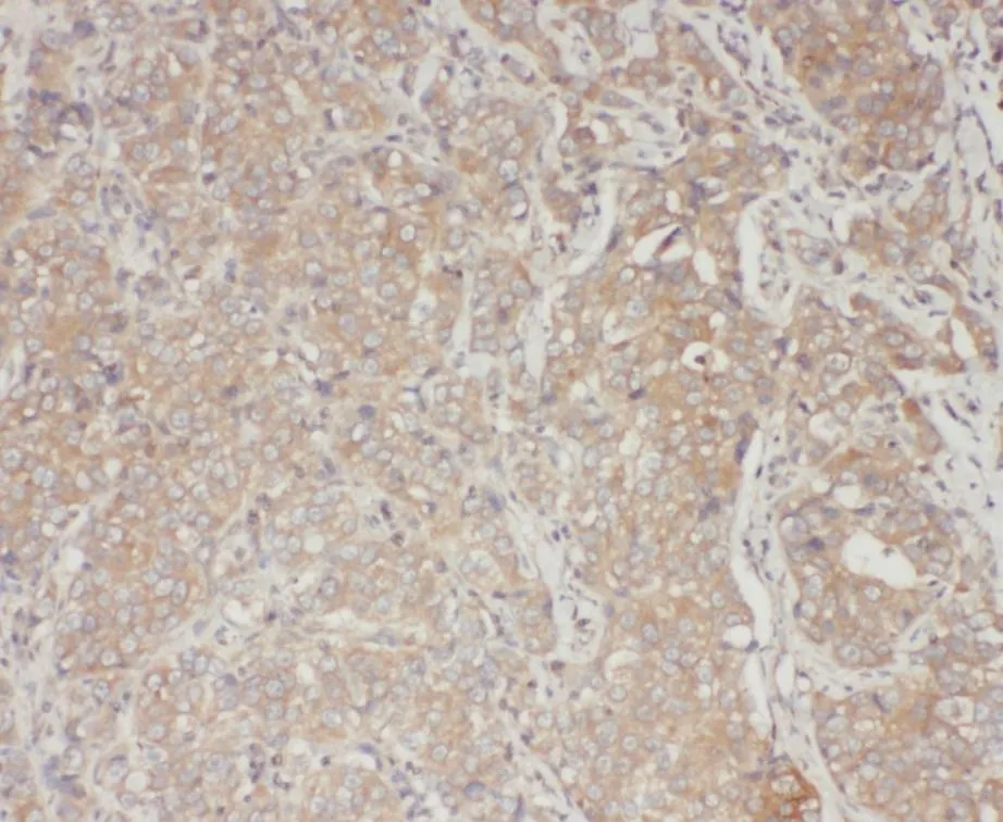 STAT3 antibody - image 1