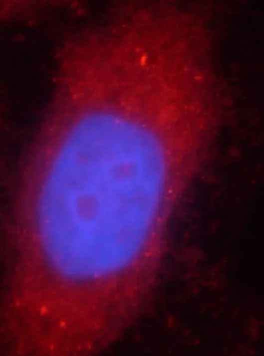 STAT3 antibody - image 2