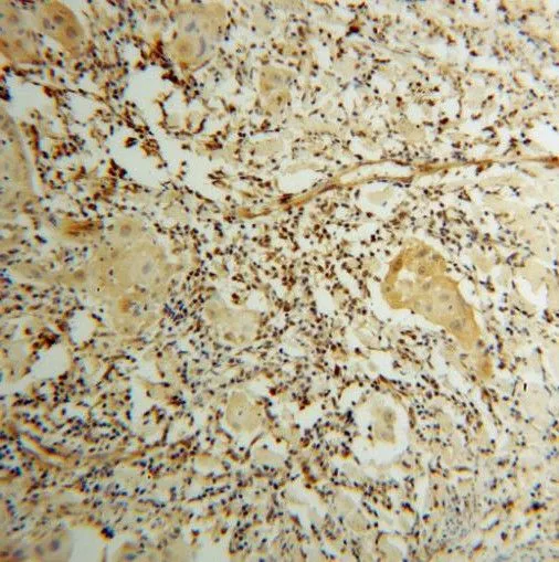 STAT3 antibody - image 1