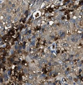 STAT3 antibody - image 1