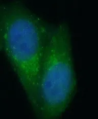 STAT3 antibody - image 2