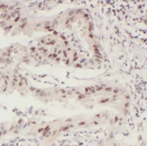 STAT5B antibody - image 1