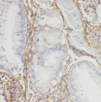 SUCLA2 antibody - image 1