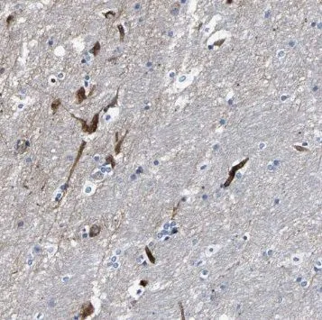 SYNGR2 antibody - image 1