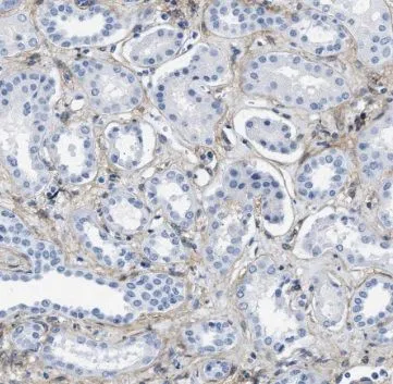 TCTN1 antibody - image 1