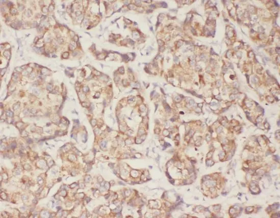 TGFB1 antibody - image 1