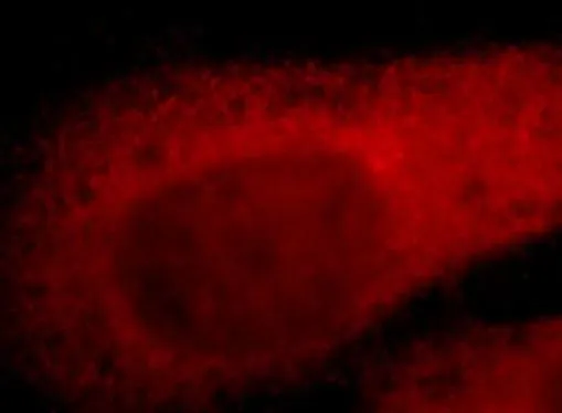 TYMS antibody - image 2