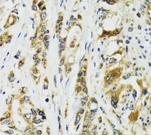 TNNC1 antibody - image 1