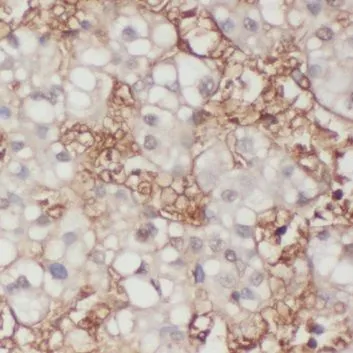 TRAK2 antibody - image 1